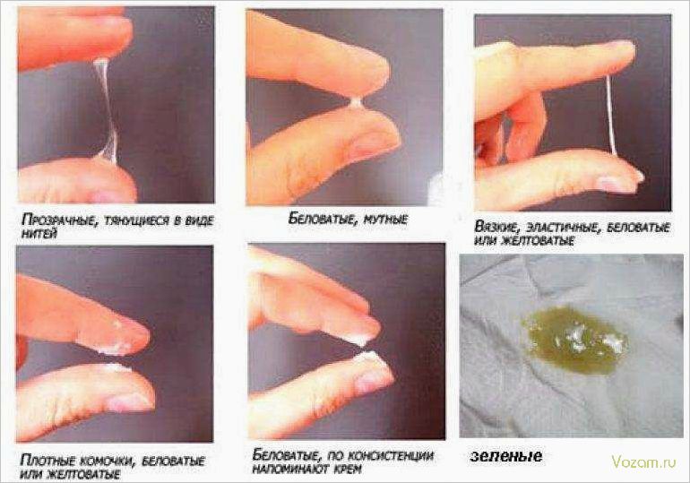 Нормальные и ненормальные выделения из влагалища